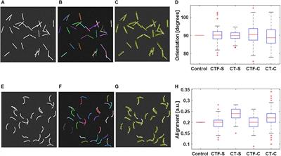 Fibrillar Collagen Quantification With Curvelet Transform Based Computational Methods